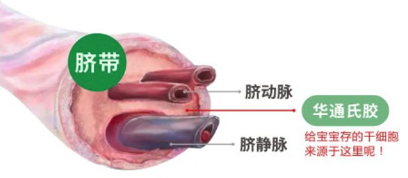Umbilical Cord Mesenchymal Stem Cells
